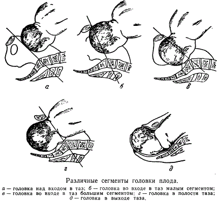 Головка плода в полости малого таза